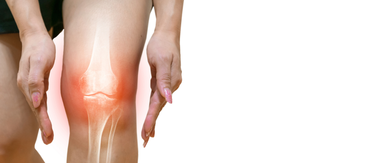 Röntgenbild-Darstellung eines Kniegelenks mit rot markiertem Bereich, zwei Hände umfassen das Knie